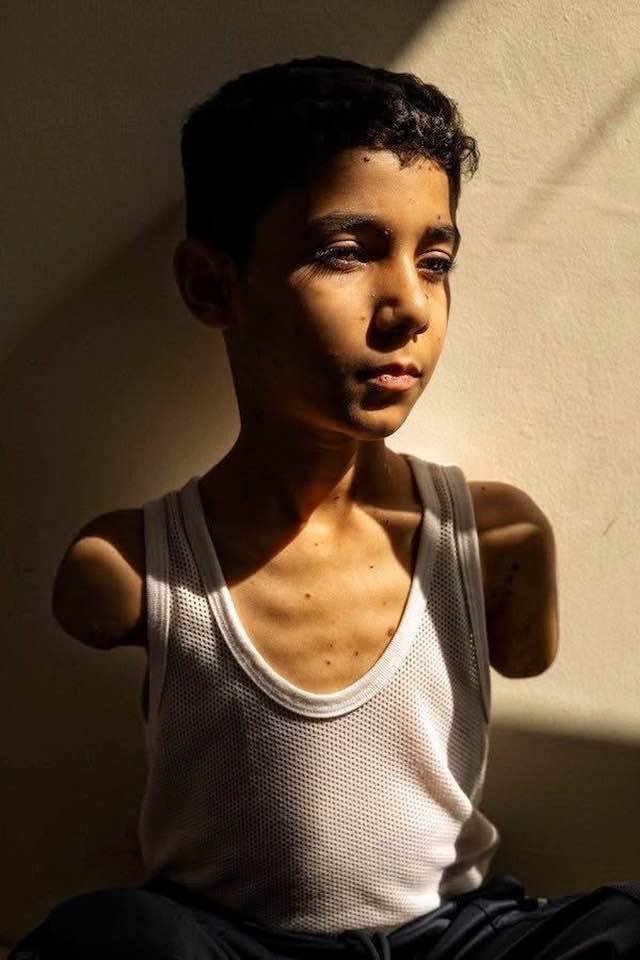La forza di Mahmoud: un ritratto di resistenza nella Gaza ferita